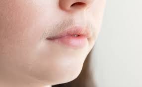 अनचाहे बाल हटाने के घरेलु उपाय (How to Remove Unwanted Hair)