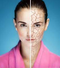 सर्दियों में रूखी त्वचा से राहत पाने के नेचुरल उपाय